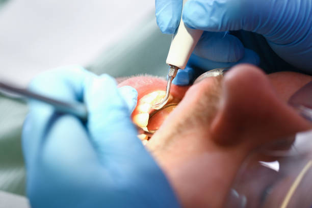 Best Tooth Infection Emergency Dentist  in Shpee Neck, MA