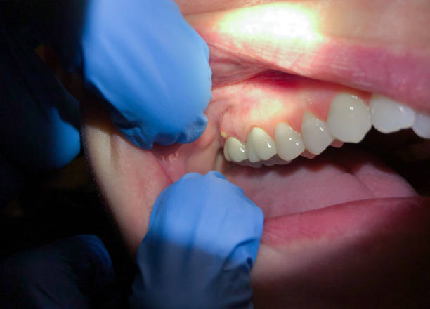 Best Dentist Open Late Near Me  in Shpee Neck, MA