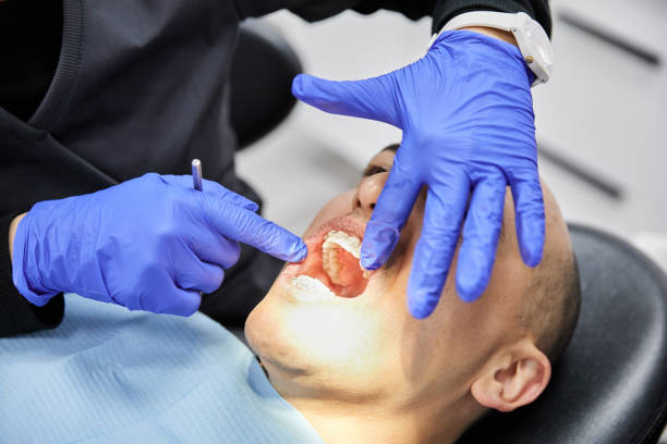 Best Knocked-Out Tooth Emergency  in Shpee Neck, MA