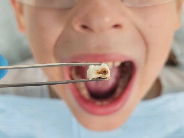 Best Broken Tooth Emergency  in Shpee Neck, MA